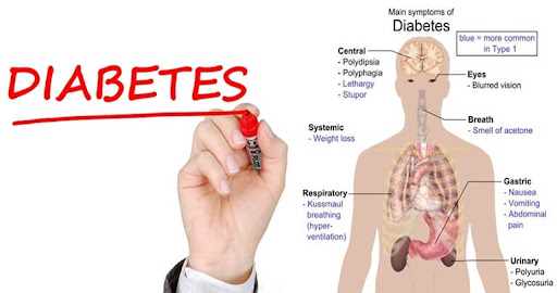 Diabetes mellitus tipe 2